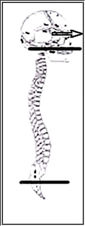 L'quilibre postural