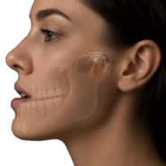 malocclusion dentaire remise en fonction par le guide postural