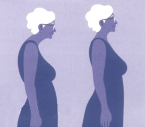 femme en posture courbée et en posture redressée
